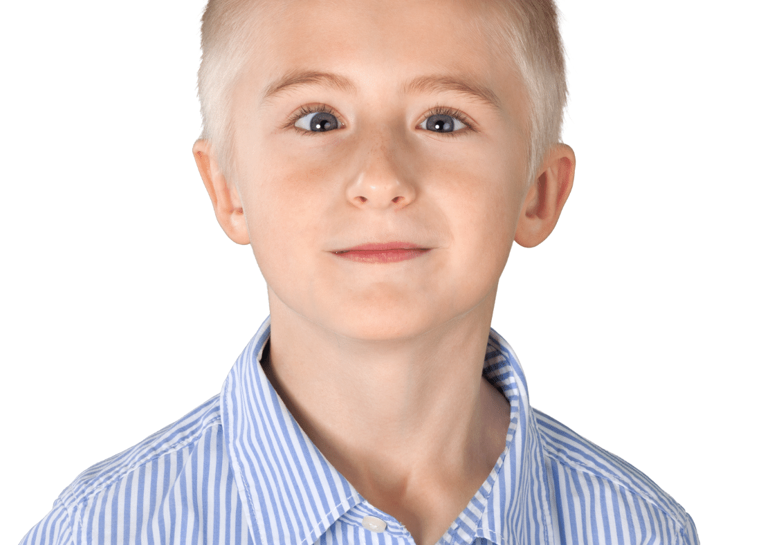 boy with a lazy eye